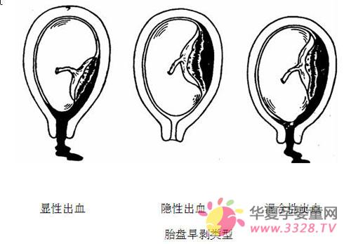 ����̥�P(p��n)�焃�Y�ԭ��